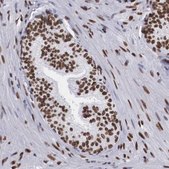 Anti-MECP2 antibody produced in rabbit Ab1, Prestige Antibodies&#174; Powered by Atlas Antibodies, affinity isolated antibody, buffered aqueous glycerol solution