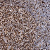 Anti-PIWIL4 antibody produced in rabbit Prestige Antibodies&#174; Powered by Atlas Antibodies, affinity isolated antibody, buffered aqueous glycerol solution