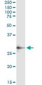 Monoclonal Anti-CECR1, (C-terminal) antibody produced in mouse clone 3D11, purified immunoglobulin, buffered aqueous solution