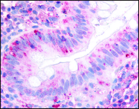 Anti-ITGA2 (AB1) antibody produced in rabbit affinity isolated antibody, buffered aqueous solution