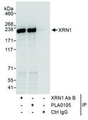 Rabbit anti-XRN1 Antibody, Affinity Purified Powered by Bethyl Laboratories, Inc.