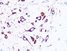 Anti-FMRP Antibody, clone 4Y8I5, Rabbit Monoclonal