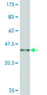 ANTI-ATOH1 antibody produced in mouse clone 2B1, purified immunoglobulin, buffered aqueous solution