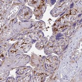 Anti-TNS3 antibody produced in rabbit Prestige Antibodies&#174; Powered by Atlas Antibodies, affinity isolated antibody, buffered aqueous glycerol solution
