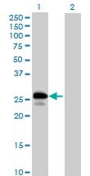 Anti-UBE2J2 antibody produced in mouse purified immunoglobulin, buffered aqueous solution