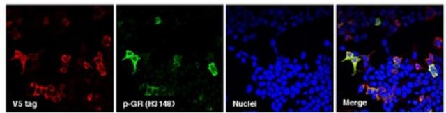 Anti-C9ORF72/C9RANT (Poly-GR) serum, from rabbit