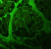 Monoclonal Anti-Collagen, Type I antibody produced in mouse clone COL-1, ascites fluid