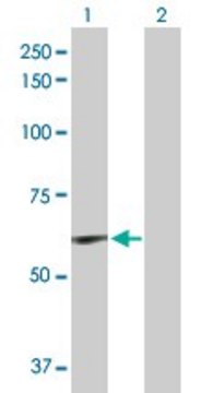 Anti-ELN antibody produced in rabbit purified immunoglobulin, buffered aqueous solution