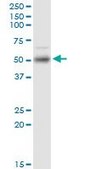 Monoclonal Anti-ETV1 antibody produced in mouse clone 4C12, purified immunoglobulin, buffered aqueous solution