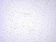 Anti-von Willebrand Factor Antibody Chemicon&#174;, from rabbit