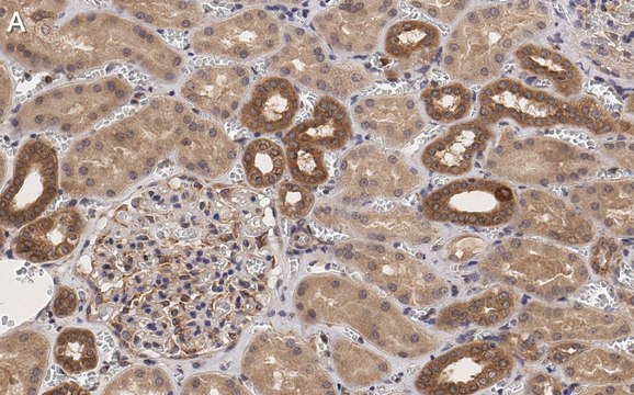 Anti-TSC2 Antibody, clone 4H10 ZooMAb&#174; Rabbit Monoclonal recombinant, expressed in HEK 293 cells