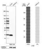 Anti-LY6D antibody produced in rabbit Prestige Antibodies&#174; Powered by Atlas Antibodies, affinity isolated antibody, buffered aqueous glycerol solution