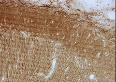 Anti-MAP2A Antibody, AP20 ascites fluid, clone AP20, Chemicon&#174;