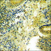 Anti-phospho-GSK3 &#945; (pSer21) antibody produced in rabbit affinity isolated antibody