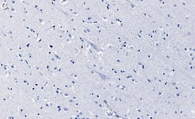 Anti-PKC&#945; Antibody, clone 2H22 ZooMAb&#174; Rabbit Monoclonal recombinant, expressed in HEK 293 cells