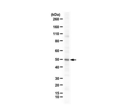 Anti-SMYD3 from rabbit