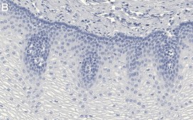 Anti-Rac1 Antibody, clone 1E9 ZooMAb&#174; Rabbit Monoclonal recombinant, expressed in HEK 293 cells
