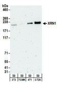 Rabbit anti-XRN1 Antibody, Affinity Purified Powered by Bethyl Laboratories, Inc.