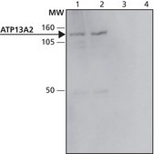 Anti-ATP13A2 antibody produced in rabbit ~1&#160;mg/mL, affinity isolated antibody, buffered aqueous solution