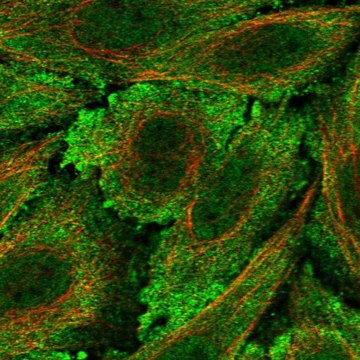 Anti-Lca5L Antibody Produced In Rabbit Prestige Antibodies&#174; Powered by Atlas Antibodies, affinity isolated antibody, buffered aqueous glycerol solution