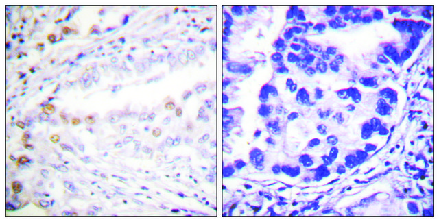 Anti-UBA2 antibody produced in rabbit affinity isolated antibody