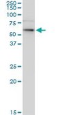 Monoclonal Anti-KRT6B antibody produced in mouse clone 1C4, purified immunoglobulin, buffered aqueous solution
