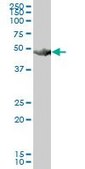 Anti-HARS antibody produced in mouse purified immunoglobulin, buffered aqueous solution