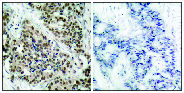 Anti-phospho-FOXO1 (pSer256) antibody produced in rabbit affinity isolated antibody