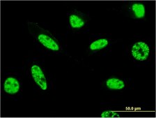 Monoclonal Anti-CCDC131 antibody produced in mouse clone 3A3, purified immunoglobulin, buffered aqueous solution