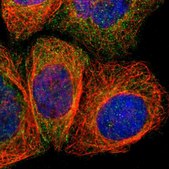 Anti-AMOTL1 antibody produced in rabbit Prestige Antibodies&#174; Powered by Atlas Antibodies, affinity isolated antibody, buffered aqueous glycerol solution