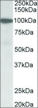 Anti-GSN (N-terminal) antibody produced in goat affinity isolated antibody, buffered aqueous solution