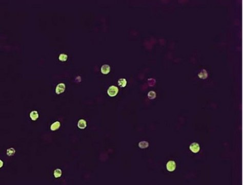 Anti-Herpes Simplex Virus I &amp; II Antibody, clone 4F10.3 clone 4F10.3, Chemicon&#174;, from mouse