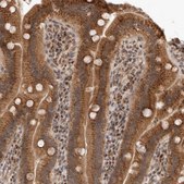 Anti-TMEM65 antibody produced in rabbit Prestige Antibodies&#174; Powered by Atlas Antibodies, affinity isolated antibody, buffered aqueous glycerol solution