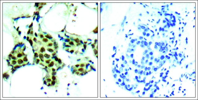 Anti-phospho-MAPK14 (pTyr182) antibody produced in rabbit affinity isolated antibody