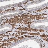 Anti-SLC43A3 antibody produced in rabbit Prestige Antibodies&#174; Powered by Atlas Antibodies, affinity isolated antibody, buffered aqueous glycerol solution