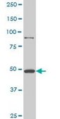 Monoclonal Anti-HD antibody produced in mouse clone 3F1, purified immunoglobulin, buffered aqueous solution