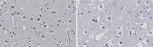 Anti-CKII-&#945; Antibody, clone 3K8 ZooMAb&#174; Rabbit Monoclonal recombinant, expressed in HEK 293 cells
