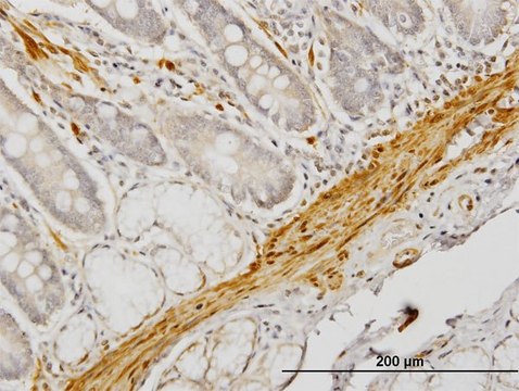 Monoclonal Anti-CNN1 antibody produced in mouse clone 2F5-1H4, purified immunoglobulin, buffered aqueous solution