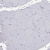 Anti-CCL27 Prestige Antibodies&#174; Powered by Atlas Antibodies, affinity isolated antibody