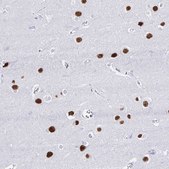 Anti-RALYL antibody produced in rabbit Prestige Antibodies&#174; Powered by Atlas Antibodies, affinity isolated antibody, buffered aqueous glycerol solution
