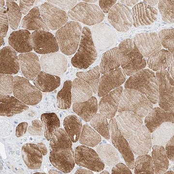 Anti-SYTL3 antibody produced in rabbit Prestige Antibodies&#174; Powered by Atlas Antibodies, affinity isolated antibody, buffered aqueous glycerol solution, ab1
