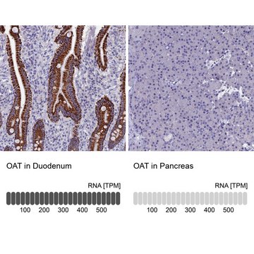 Anti-OAT antibody produced in rabbit Prestige Antibodies&#174; Powered by Atlas Antibodies, affinity isolated antibody, buffered aqueous glycerol solution