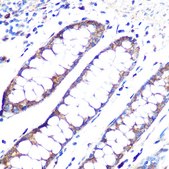 Anti-ANGPT1 Antibody, clone 6C4S7, Rabbit Monoclonal