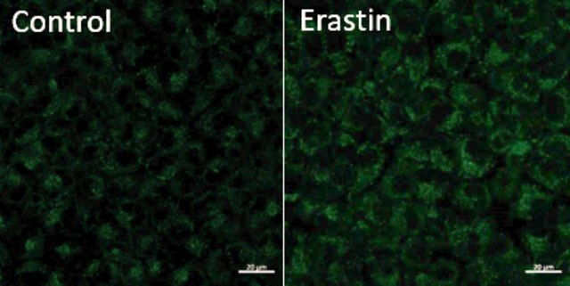 BioTracker&#8482; Green Lipid Peroxide Live Cell Ferroptosis Indicator