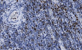 Anti-RUNX2 Antibody, clone 1D6 ZooMAb&#174; Rabbit Monoclonal recombinant, expressed in HEK 293 cells