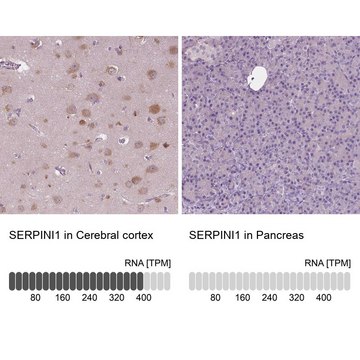 Anti-SERPINI1 antibody produced in rabbit Prestige Antibodies&#174; Powered by Atlas Antibodies, affinity isolated antibody, buffered aqueous glycerol solution