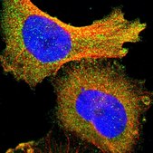 Anti-PIK3R1 antibody produced in rabbit Ab1, Prestige Antibodies&#174; Powered by Atlas Antibodies, affinity isolated antibody, buffered aqueous glycerol solution