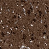 Anti-DCLK1 antibody produced in rabbit Prestige Antibodies&#174; Powered by Atlas Antibodies, affinity isolated antibody, buffered aqueous glycerol solution