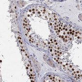 Anti-PRC1 antibody produced in rabbit Prestige Antibodies&#174; Powered by Atlas Antibodies, affinity isolated antibody, buffered aqueous glycerol solution