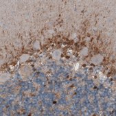 Monoclonal Anti-GLUL antibody produced in mouse Prestige Antibodies&#174; Powered by Atlas Antibodies, clone CL3004, purified immunoglobulin, buffered aqueous glycerol solution